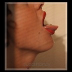 redhear avatar